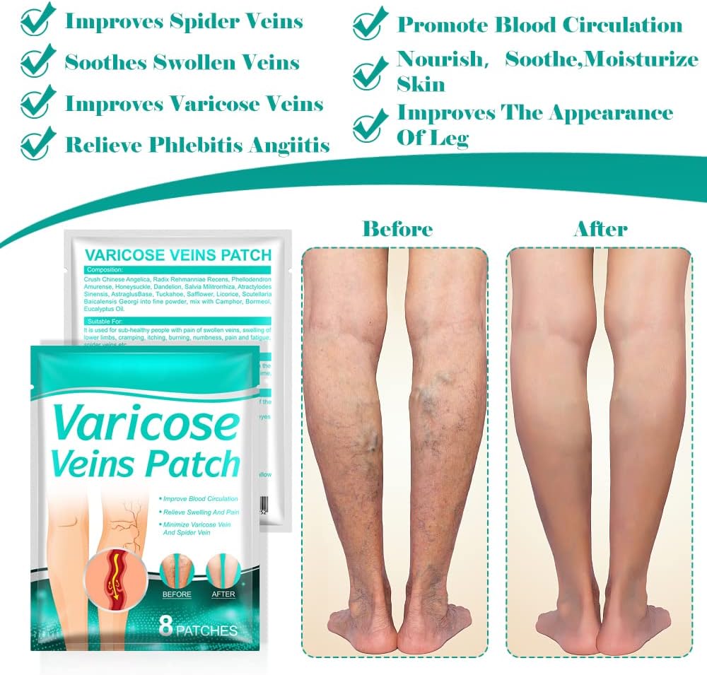 Varicose Max™ - Parches Antivarices