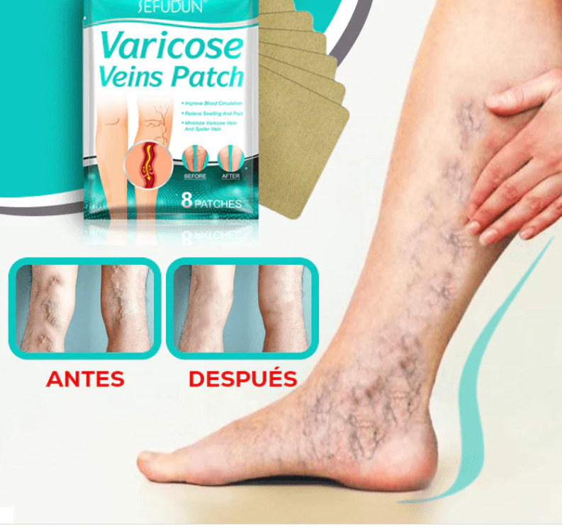 Varicose Max™ - Parches Antivarices